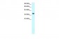 NPM1 antibody - N-terminal region
